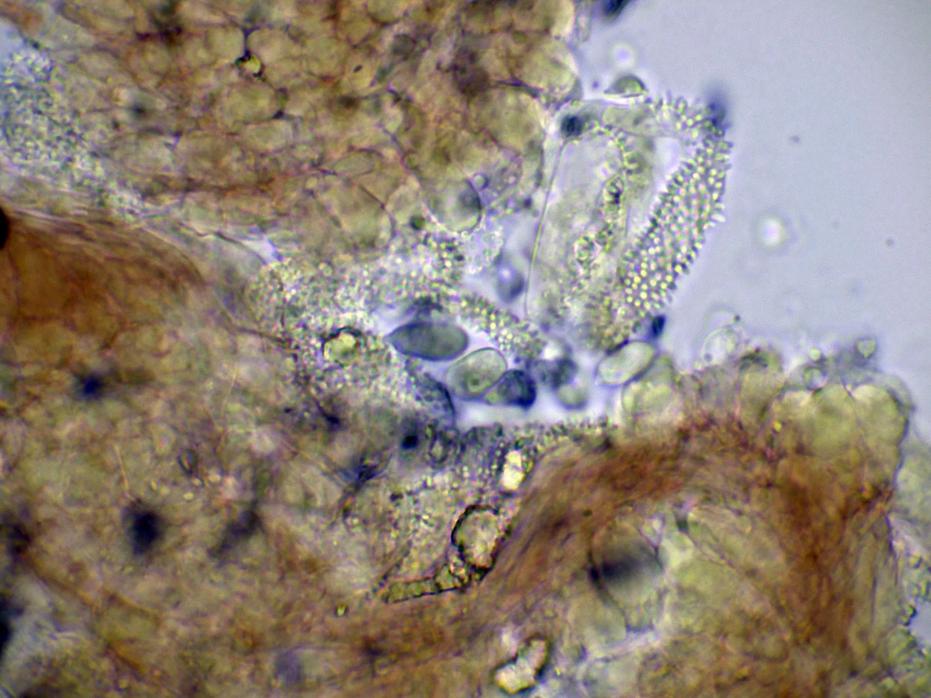 Microscopía de Mycena quercus-ilicis - 10 - Suprapellis Melzer-002